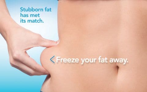 Hips treatment Farnham From Lipo Sculpt