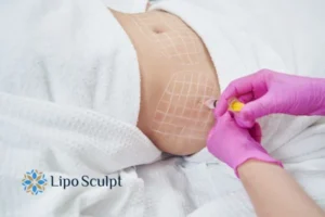 Are The Results From Aqualyx Permanent? 1 Do you want to know how long Aqualyx Farnham results last?