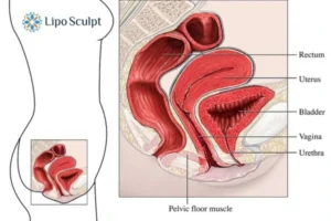 Treatment For A Leaky Bladder 2 How EM Chair treatment Farnham can help Leaky bladder issues. Read more now!