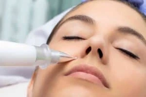 Best Actinic Keratoses Removal 3 Actinic keratoses Farnham solutions - book in today!