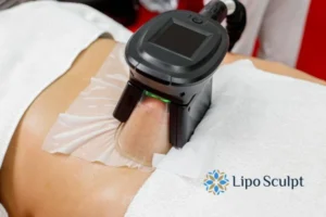 Does Fat Freezing At Home Work? 3 Fat freezing at home from Lipo Sculpt Farnham
